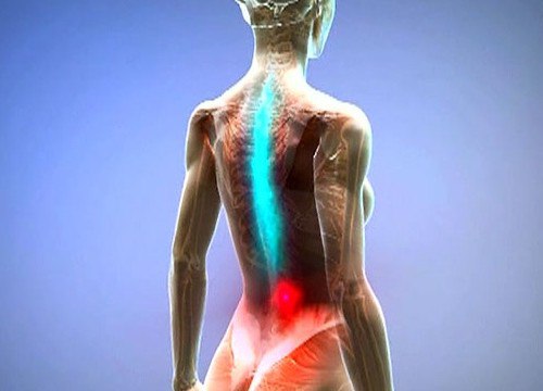 Массаж при спазме мышц спины